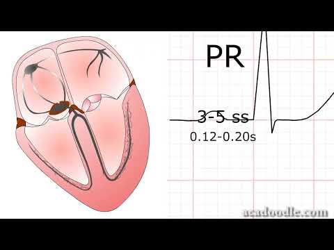 Become an ECG guru! ეკგ მარტივად და გასაგებად. #drpkhakadze